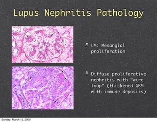 Glomerulonephritis