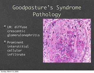 Glomerulonephritis
