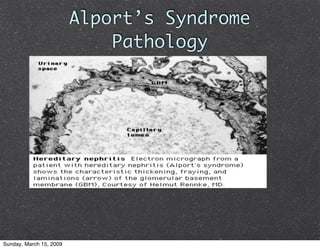 Glomerulonephritis
