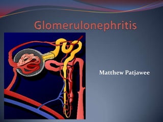 Glomerulonephritis Matthew Patjawee 