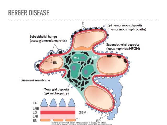 Glomerulonephritis