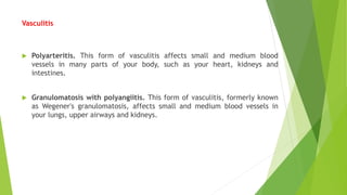 Vasculitis
 Polyarteritis. This form of vasculitis affects small and medium blood
vessels in many parts of your body, such as your heart, kidneys and
intestines.
 Granulomatosis with polyangiitis. This form of vasculitis, formerly known
as Wegener's granulomatosis, affects small and medium blood vessels in
your lungs, upper airways and kidneys.
 