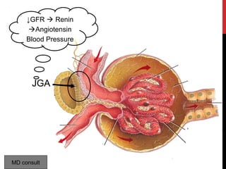 12
JGA
↓GFR  Renin
Angiotensin
Blood Pressure
MD consult
 