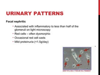 21
URINARY PATTERNS
Focal nephritic
• Associated with inflammatory to less than half of the
glomeruli on light microscopy
• Red cells – often dysmorphic
• Occasional red cell casts
• Mild proteinuria (<1.5g/day)
 