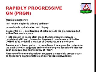 37
RAPIDLY PROGRESSIVE
GN (PRGN)
Medical emergency
‘full house’ nephritic urinary sediment
Immediate hospitalisation and biopsy
Crescentic GN – proliferation of cells outside the glomerulus, but
within Bowman’s space
If IgG present in linear stain along the basement membrane –
consistent with anti glomerular basement membrane antibiodies
(AGBM ab’s) which is a marker of Goodpasture’s syndrome
Presence of a linear pattern or complement in a granular pattern on
the capillary wall suggests an immune complex associated disease
such as lupus, IgA nephropathy of PSGN
Absence of immune deposition suggests a vasculitic process such
as Wegener’s granulomatosis or microscopic polyangiitis
 