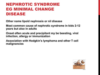 44
NEPHROTIC SYNDROME
EG MINIMAL CHANGE
DISEASE
Other name lipoid nephrosis or nil disease
Most common cause of nephrotic syndrome in kids 2-12
years but also in adults
Onset often acute and precipitant my be beesting, viral
infection, allergy or immunization
Association with Hodgkin’s lymphoma and other T cell
malignancies
 