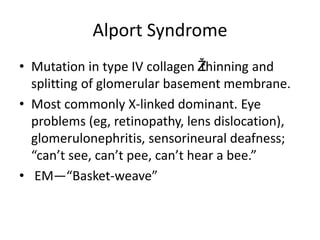 Alport Syndrome
• Mutation in type IV collagen Ž
thinning and
splitting of glomerular basement membrane.
• Most commonly X-linked dominant. Eye
problems (eg, retinopathy, lens dislocation),
glomerulonephritis, sensorineural deafness;
“can’t see, can’t pee, can’t hear a bee.”
• EM—“Basket-weave”
 