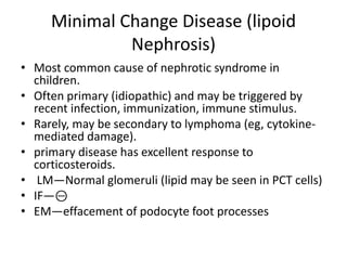 Minimal Change Disease (lipoid
Nephrosis)
• Most common cause of nephrotic syndrome in
children.
• Often primary (idiopathic) and may be triggered by
recent infection, immunization, immune stimulus.
• Rarely, may be secondary to lymphoma (eg, cytokine-
mediated damage).
• primary disease has excellent response to
corticosteroids.
• LM—Normal glomeruli (lipid may be seen in PCT cells)
• IF—⊝
• EM—effacement of podocyte foot processes
 