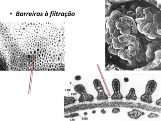 • Barreiras à filtração

 