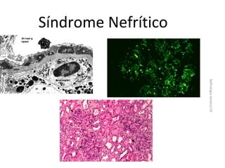 Síndrome Nefrítico

Nefrologia Janeiro/10

 