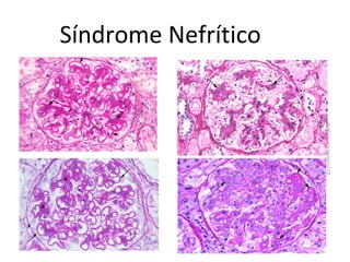 Síndrome Nefrítico

Nefrologia Janeiro/10

 