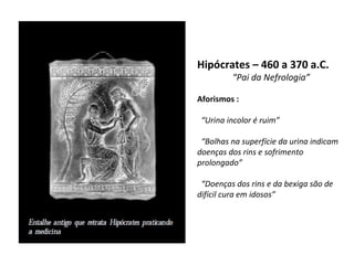 Hipócrates – 460 a 370 a.C.
“Pai da Nefrologia”

Aforismos :
“Urina incolor é ruim”
“Bolhas na superfície da urina indicam
doenças dos rins e sofrimento
prolongado”
“Doenças dos rins e da bexiga são de
difícil cura em idosos”

 