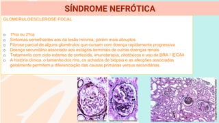 GLOMERULOESCLEROSE FOCAL
o 1ªria ou 2ªria
o Sintomas semelhantes aos da lesão mínima, porém mais abruptos
o Fibrose parcial de alguns glomérulos que cursam com doença rapidamente progressiva
o Doença secundária associado aos estágios terminais de outras doenças renais
o Tratamento com ciclo extenso de corticoide, imunoterapia, citotóxicos e uso de BRA / IECA4
o A história clínica, o tamanho dos rins, os achados de biópsia e as afecções associadas
geralmente permitem a diferenciação das causas primárias versus secundárias.
SÍNDROME NEFRÓTICA
 