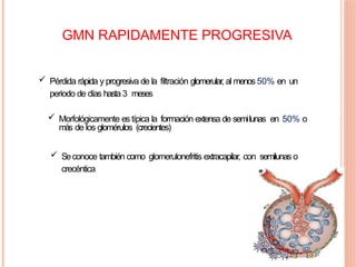 GMN RAPIDAMENTE PROGRESIVA
 Pérdida rápida y progresiva de la filtración glomerular, al menos 50% en un
periodo de días hasta 3 meses
 Morfológicamente es típica la formación extensa de semilunas en 50% o
más de los glomérulos (crecientes)
 Seconoce también como glomerulonefritis extracapilar, con semilunas o
crecéntica
 