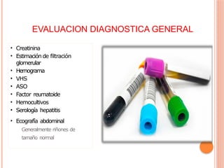 EVALUACION DIAGNOSTICA GENERAL
• Creatinina
• Estimación de filtración
glomerular
• Hemograma
• VHS
• ASO
• Factor reumatoide
• Hemocultivos
• Serología hepatitis
• Ecografía abdominal
Generalmente riñones de
tamaño normal
 
