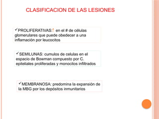 CLASIFICACION DE LAS LESIONES
PROLIFERATIVAS: en el # de células
glomerulares que puede obedecer a una
inflamación por leucocitos
SEMILUNAS: cumulos de celulas en el
espacio de Bowman compuesto por C.
epiteliales proliferadas y monocitos infiltrados
MEMBRANOSA: predomina la expansión de
la MBG por los depósitos inmunitarios
 