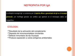 NEFROPATIA POR IgA
ETIOLOGIA:
Resultado de la activación del complemento
Deposito de inmunocomplejos circulantes
Defecto inmunitario de las mucosas
Produce exposición a varios antígenos ambientales
 