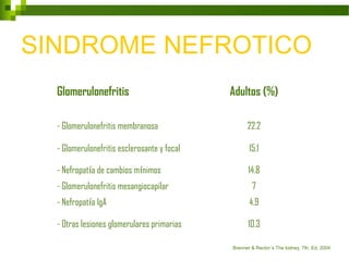 Glomerulonefritis Adultos (%)
- Glomerulonefritis membranosa 22.2
- Glomerulonefritis esclerosante y focal 15.1
- Nefropatía de cambios mínimos 14.8
- Glomerulonefritis mesangiocapilar 7
- Nefropatía IgA 4.9
- Otras lesiones glomerulares primarias 10.3
Brenner & Rector´s The kidney, 7th. Ed, 2004
SINDROME NEFROTICO
 