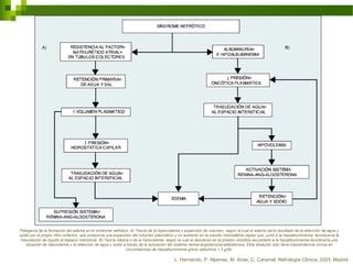 Patogenia de la formación del edema en el síndrome nefrótico. A) Teoría de la hipervolemia o expansión de volumen, según la cual el edema sería resultado de la retención de agua y
sodio por el propio riñón enfermo, que produciría una expansión del volumen plasmático y un aumento en la presión hidrostática capilar que, junto a la hipoalbuminemia, favorecería la
trasudación de líquido al espacio intersticial. B) Teoría clásica o de la hipovolemia, según la cual el descenso en la presión oncótica secundario a la hipoalbuminemia favorecería una
situación de hipovolemia y la retención de agua y sodio a través de la activación del sistema renina-angiotensina-aldosterona. Esta situación sólo tiene trascendencia clínica en
circunstancias de hipoalbuminemia grave (albúmina < 2 g/dl).
L. Hernando, P. Aljamas, M. Arias, C. Caramel. Nefrología Clínica, 2003. Madrid.
 