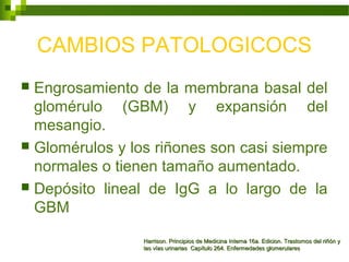 CAMBIOS PATOLOGICOCS
 Engrosamiento de la membrana basal del
glomérulo (GBM) y expansión del
mesangio.
 Glomérulos y los riñones son casi siempre
normales o tienen tamaño aumentado.
 Depósito lineal de IgG a lo largo de la
GBM
Harrison. Principios de Medicina Interna 16a. Edicion. Trastornos del riñón yHarrison. Principios de Medicina Interna 16a. Edicion. Trastornos del riñón y
las vías urinarias Capítulo 264. Enfermedades glomerulareslas vías urinarias Capítulo 264. Enfermedades glomerulares
 