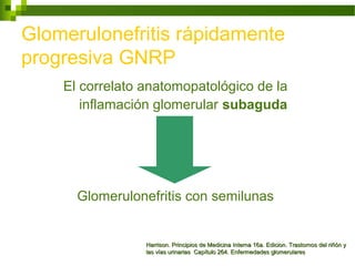 Glomerulonefritis rápidamente
progresiva GNRP
El correlato anatomopatológico de la
inflamación glomerular subaguda
Glomerulonefritis con semilunas
Harrison. Principios de Medicina Interna 16a. Edicion. Trastornos del riñón yHarrison. Principios de Medicina Interna 16a. Edicion. Trastornos del riñón y
las vías urinarias Capítulo 264. Enfermedades glomerulareslas vías urinarias Capítulo 264. Enfermedades glomerulares
 
