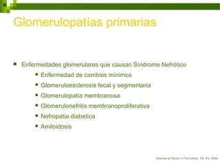 Glomerulopatías primarias
 Enfermedades glomerulares que causan Síndrome Nefrótico
 Enfermedad de cambios mínimos
 Glomeruloesclerosis focal y segmentaria
 Glomerulopatía membranosa
 Glomerulonefritis membranoproliferativa
 Nefropatia diabetica
 Amiloidosis
Brenner & Rector´s The kidney, 7th. Ed, 2004
 
