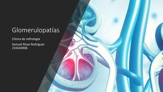 Glomerulopatías
Clínica de nefrología
Samuel Rivas Rodríguez
216544906
 