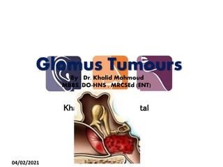 Khartoum ENT Hospital
Glomus Tumours
By : Dr. Khalid Mahmoud
MBBS, DO-HNS , MRCSEd (ENT)
04/02/2021
 