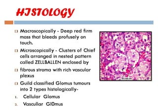 Glomus tumor