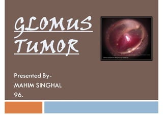 Glomus tumor