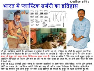 जी हां, प्लास्स्टक सजिर के आववष्कार से िुतनया में िांति आ गई। पस्श्चम के लोगों के अनुसार प्लास्स्टक
सजिर आधुतनक ववज्ञान की िेन है। प्लास्स्टक सजिर का मिलब है- ‘शर र के ककसी दहस्से को ठीक करना।’
भारि में सुश्रुि को पहला शल्य गचककत्सक माना जािा है। आज से कर ब 3,000 साल पहले सुश्रुि युद्ध या
प्राकृ तिक ववपिाओं में स्जनके अंग-भंग हो जािे थे या नाक खराब हो जािी थी, िो उन्हें ठीक करने का काम
वे करिे थे।
सुश्रुि ने 1,000 ईसापूवि अपने समय के स्वास्थ्य वैज्ञातनकों के साथ प्रसव, मोतियात्रबंि, कृ त्ररम अंग लगाना,
पथर का इलाज और प्लास्स्टक सजिर जैसी कई िरह की जदटल शल्य गचककत्सा के र्सद्धांि प्रतिपादिि
ककए थे। हालांकक कु छ लोग सुश्रुि का काल 800 ईसापूवि का मानिे हैं। सुश्रुि से पहले धन्वंिरर हुए थे।
4.प्लास्स्टक सजिर :
 