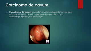 Glosario DE ANATOMÍA II | PPTX