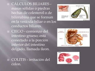  CÁLCULOS BILIARES -
masas sólidas o piedras
hechas de colesterol o de
bilirrubina que se forman
en la vesícula biliar o en los
conductos biliares.
 CIEGO - comienzo del
intestino grueso; está
conectado a la porción
inferior del intestino
delgado, llamada íleon.
 COLITIS - irritación del
colon.
 
