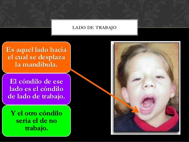 Glosario de oclusión