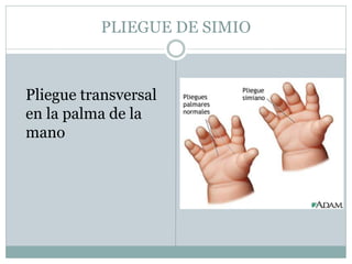 Glosario Medico Genetica Medica PDF