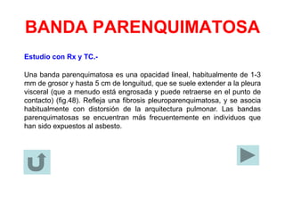 BANDA PARENQUIMATOSA
Estudio con Rx y TC.-
Una banda parenquimatosa es una opacidad lineal, habitualmente de 1-3
mm de grosor y hasta 5 cm de longuitud, que se suele extender a la pleura
visceral (que a menudo está engrosada y puede retraerse en el punto de
contacto) (fig.48). Refleja una fibrosis pleuroparenquimatosa, y se asocia
habitualmente con distorsión de la arquitectura pulmonar. Las bandas
parenquimatosas se encuentran más frecuentemente en individuos que
han sido expuestos al asbesto.
 
