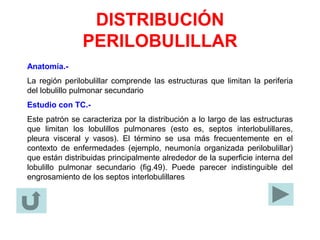 DISTRIBUCIÓN
PERILOBULILLAR
Anatomía.-
La región perilobulillar comprende las estructuras que limitan la periferia
del lobulillo pulmonar secundario
Estudio con TC.-
Este patrón se caracteriza por la distribución a lo largo de las estructuras
que limitan los lobulillos pulmonares (esto es, septos interlobulillares,
pleura visceral y vasos). El término se usa más frecuentemente en el
contexto de enfermedades (ejemplo, neumonía organizada perilobulillar)
que están distribuidas principalmente alrededor de la superficie interna del
lobulillo pulmonar secundario (fig.49). Puede parecer indistinguible del
engrosamiento de los septos interlobulillares
 