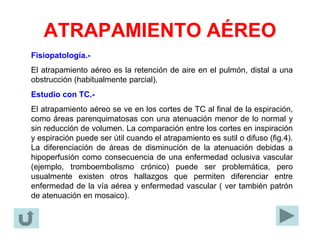 ATRAPAMIENTO AÉREO
Fisiopatología.-
El atrapamiento aéreo es la retención de aire en el pulmón, distal a una
obstrucción (habitualmente parcial).
Estudio con TC.-
El atrapamiento aéreo se ve en los cortes de TC al final de la espiración,
como áreas parenquimatosas con una atenuación menor de lo normal y
sin reducción de volumen. La comparación entre los cortes en inspiración
y espiración puede ser útil cuando el atrapamiento es sutil o difuso (fig.4).
La diferenciación de áreas de disminución de la atenuación debidas a
hipoperfusión como consecuencia de una enfermedad oclusiva vascular
(ejemplo, tromboembolismo crónico) puede ser problemática, pero
usualmente existen otros hallazgos que permiten diferenciar entre
enfermedad de la vía aérea y enfermedad vascular ( ver también patrón
de atenuación en mosaico).
 