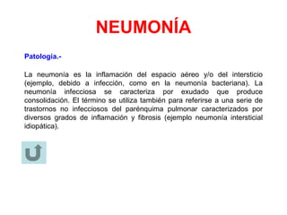 NEUMONÍA
Patología.-
La neumonía es la inflamación del espacio aéreo y/o del intersticio
(ejemplo, debido a infección, como en la neumonía bacteriana). La
neumonía infecciosa se caracteriza por exudado que produce
consolidación. El término se utiliza también para referirse a una serie de
trastornos no infecciosos del parénquima pulmonar caracterizados por
diversos grados de inflamación y fibrosis (ejemplo neumonía intersticial
idiopática).
 