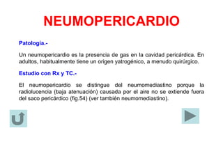 NEUMOPERICARDIO
Patología.-
Un neumopericardio es la presencia de gas en la cavidad pericárdica. En
adultos, habitualmente tiene un origen yatrogénico, a menudo quirúrgico.
Estudio con Rx y TC.-
El neumopericardio se distingue del neumomediastino porque la
radiolucencia (baja atenuación) causada por el aire no se extiende fuera
del saco pericárdico (fig.54) (ver también neumomediastino).
 