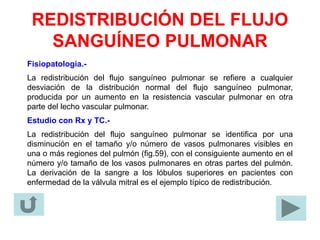 REDISTRIBUCIÓN DEL FLUJO
SANGUÍNEO PULMONAR
Fisiopatología.-
La redistribución del flujo sanguíneo pulmonar se refiere a cualquier
desviación de la distribución normal del flujo sanguíneo pulmonar,
producida por un aumento en la resistencia vascular pulmonar en otra
parte del lecho vascular pulmonar.
Estudio con Rx y TC.-
La redistribución del flujo sanguíneo pulmonar se identifica por una
disminución en el tamaño y/o número de vasos pulmonares visibles en
una o más regiones del pulmón (fig.59), con el consiguiente aumento en el
número y/o tamaño de los vasos pulmonares en otras partes del pulmón.
La derivación de la sangre a los lóbulos superiores en pacientes con
enfermedad de la válvula mitral es el ejemplo típico de redistribución.
 