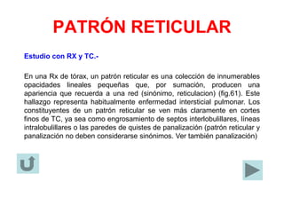PATRÓN RETICULAR
Estudio con RX y TC.-
En una Rx de tórax, un patrón reticular es una colección de innumerables
opacidades lineales pequeñas que, por sumación, producen una
apariencia que recuerda a una red (sinónimo, reticulacion) (fig.61). Este
hallazgo representa habitualmente enfermedad intersticial pulmonar. Los
constituyentes de un patrón reticular se ven más claramente en cortes
finos de TC, ya sea como engrosamiento de septos interlobulillares, líneas
intralobulillares o las paredes de quistes de panalización (patrón reticular y
panalización no deben considerarse sinónimos. Ver también panalización)
 