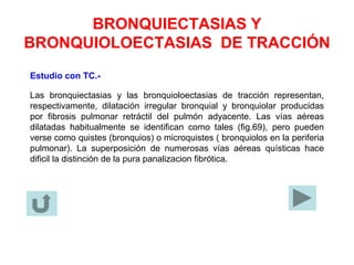 BRONQUIECTASIAS Y
BRONQUIOLOECTASIAS DE TRACCIÓN
Estudio con TC.-
Las bronquiectasias y las bronquioloectasias de tracción representan,
respectivamente, dilatación irregular bronquial y bronquiolar producidas
por fibrosis pulmonar retráctil del pulmón adyacente. Las vías aéreas
dilatadas habitualmente se identifican como tales (fig.69), pero pueden
verse como quistes (bronquios) o microquistes ( bronquiolos en la periferia
pulmonar). La superposición de numerosas vías aéreas quísticas hace
dificil la distinción de la pura panalizacion fibrótica.
 
