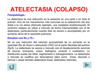 ATELECTASIA (COLAPSO)
Fisiopatología.-
La atelectasia es una reducción en la aireación en una parte o en todo el
pulmón. Uno de los mecanismos más comunes es la reabsorción del aire
distal a la vía aérea obstruida (ejemplo, una neoplasia endobronquial). El
sinónimo colapso se utiliza a menudo de forma intercambiable con el de
atelectasia, particularmente cuando éste es severo o acompañado por un
aumento obvio de la opacidad pulmonar.
Estudios con Rx y TC.-
Se ve una reducción del volumen acompañada de un aumento en la
opacidad (Rx de tórax) o atenuación (TAC) en la parte afectada del pulmón
(fig.8). La atelectasia se asocia a menudo con el desplazamiento anormal
de cisuras, bronquios, vasos, diafragma, corazón o mediastino. La
distribución puede ser lobar, segmentaria o subsegmentaria. La atelectasia
a menudo se cualifica por descriptores tales como linear, discoide o
laminar ( véase también atelectasia linear, atelectasia redonda).
 