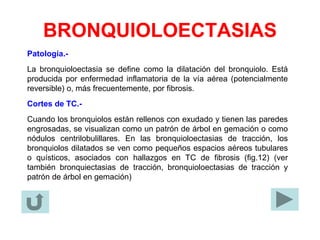 BRONQUIOLOECTASIAS
Patología.-
La bronquioloectasia se define como la dilatación del bronquiolo. Está
producida por enfermedad inflamatoria de la vía aérea (potencialmente
reversible) o, más frecuentemente, por fibrosis.
Cortes de TC.-
Cuando los bronquiolos están rellenos con exudado y tienen las paredes
engrosadas, se visualizan como un patrón de árbol en gemación o como
nódulos centrilobulillares. En las bronquioloectasias de tracción, los
bronquiolos dilatados se ven como pequeños espacios aéreos tubulares
o quísticos, asociados con hallazgos en TC de fibrosis (fig.12) (ver
también bronquiectasias de tracción, bronquioloectasias de tracción y
patrón de árbol en gemación)
 