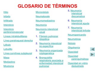 GLOSARIO DE TÉRMINOS
Hilio
Infarto
Infiltrado
Intersticio
Intersticio
peribroncovascular
Líneas intralobulillares
Línea paratraqueal derecha
Lóbulo
Lobulillo
Línea curvilínea subpleural
Masa
Mediastino
Micetoma
Micronódulo
Neumatocele
Neumomediastino
Neumonía
Neumonía intersticial
usual
1. Fibrosis pulmonar
idiopática
2. Neumonía intersticial
no específica
3. Neumonía organizada
criptogenética
4. Bronquiolitis
respiratoria asociada a
enfermedad intersticial
pulmonar
5. Neumonía
intersticial
descamativa
6. Neumonía
intersticial aguda
7. Neumonía
intersticial linfoide
Neumopericardio
Neumotórax
Nódulo
Oligohemia
Opacidad
Opacidad
parenquimatosa
Opacidad en vidrio
deslustrado
 