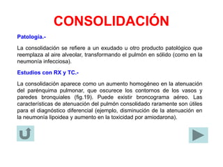 CONSOLIDACIÓN
Patología.-
La consolidación se refiere a un exudado u otro producto patológico que
reemplaza al aire alveolar, transformando el pulmón en sólido (como en la
neumonía infecciosa).
Estudios con RX y TC.-
La consolidación aparece como un aumento homogéneo en la atenuación
del parénquima pulmonar, que oscurece los contornos de los vasos y
paredes bronquiales (fig.19). Puede existir broncograma aéreo. Las
características de atenuación del pulmón consolidado raramente son útiles
para el diagnóstico diferencial (ejemplo, disminución de la atenuación en
la neumonía lipoidea y aumento en la toxicidad por amiodarona).
 