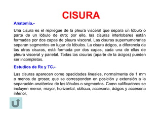 CISURA
Anatomía.-
Una cisura es el repliegue de la pleura visceral que separa un lóbulo o
parte de un lóbulo de otro; por ello, las cisuras interlobares están
formadas por dos capas de pleura visceral. Las cisuras supernumerarias
separan segmentos en lugar de lóbulos. La cisura ácigos, a diferencia de
las otras cisuras, está formada por dos capas, cada una de ellas de
pleura visceral y parietal. Todas las cisuras (aparte de la ácigos) pueden
ser incompletas.
Estudios de Rx y TC.-
Las cisuras aparecen como opacidades lineales, normalmente de 1 mm
o menos de grosor, que se corresponden en posición y extensión a la
separación anatómica de los lóbulos o segmentos. Como calificadores se
incluyen menor, mayor, horizontal, oblicua, accesoria, ácigos y accesoria
inferior.
 