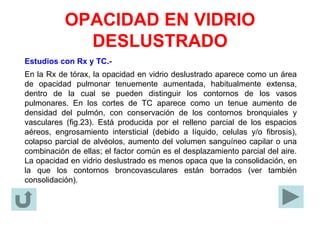 OPACIDAD EN VIDRIO
DESLUSTRADO
Estudios con Rx y TC.-
En la Rx de tórax, la opacidad en vidrio deslustrado aparece como un área
de opacidad pulmonar tenuemente aumentada, habitualmente extensa,
dentro de la cual se pueden distinguir los contornos de los vasos
pulmonares. En los cortes de TC aparece como un tenue aumento de
densidad del pulmón, con conservación de los contornos bronquiales y
vasculares (fig.23). Está producida por el relleno parcial de los espacios
aéreos, engrosamiento intersticial (debido a líquido, celulas y/o fibrosis),
colapso parcial de alvéolos, aumento del volumen sanguíneo capilar o una
combinación de ellas; el factor común es el desplazamiento parcial del aire.
La opacidad en vidrio deslustrado es menos opaca que la consolidación, en
la que los contornos broncovasculares están borrados (ver también
consolidación).
 