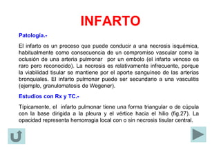 INFARTO
Patología.-
El infarto es un proceso que puede conducir a una necrosis isquémica,
habitualmente como consecuencia de un compromiso vascular como la
oclusión de una arteria pulmonar por un embolo (el infarto venoso es
raro pero reconocido). La necrosis es relativamente infrecuente, porque
la viabilidad tisular se mantiene por el aporte sanguíneo de las arterias
bronquiales. El infarto pulmonar puede ser secundario a una vasculitis
(ejemplo, granulomatosis de Wegener).
Estudios con Rx y TC.-
Típicamente, el infarto pulmonar tiene una forma triangular o de cúpula
con la base dirigida a la pleura y el vértice hacia el hilio (fig.27). La
opacidad representa hemorragia local con o sin necrosis tisular central.
 